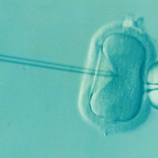 IVF Twins – Is Conceiving Possible?